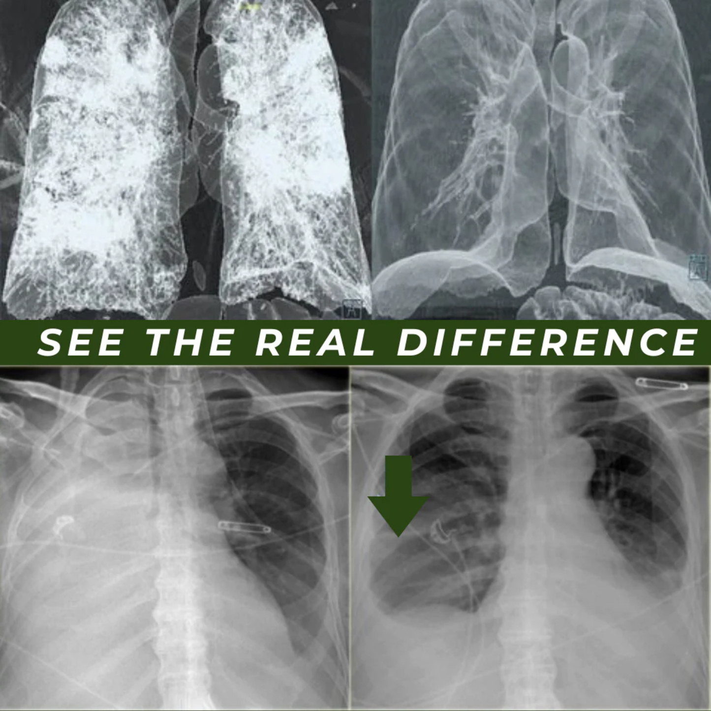 CambusCo Clear Lungs Detox Tea - Limited Time Deal