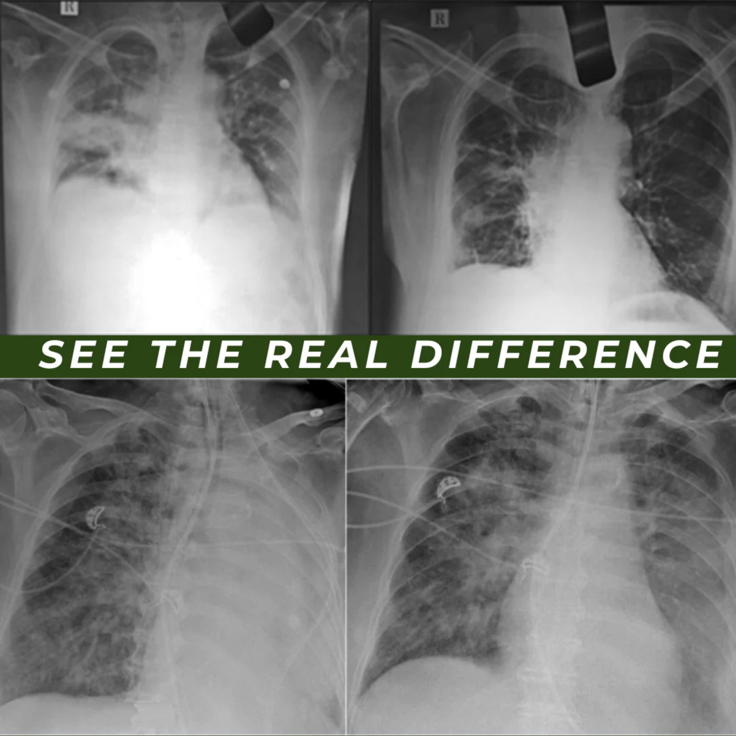 CambusCo TEA BAGS FOR LUNG DETOX