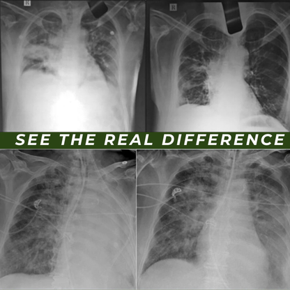 CambusCo TEA BAGS FOR LUNG DETOX